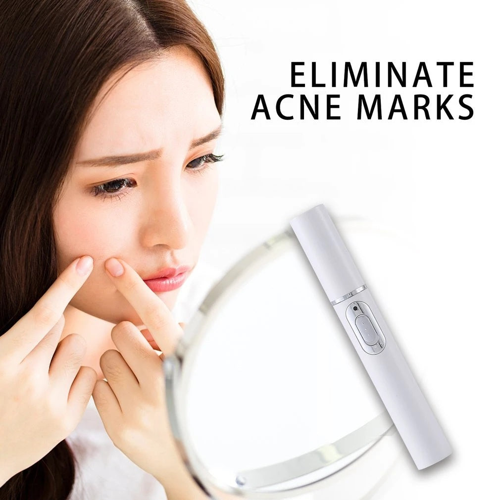 LumiGlow - Acne Laser Pen