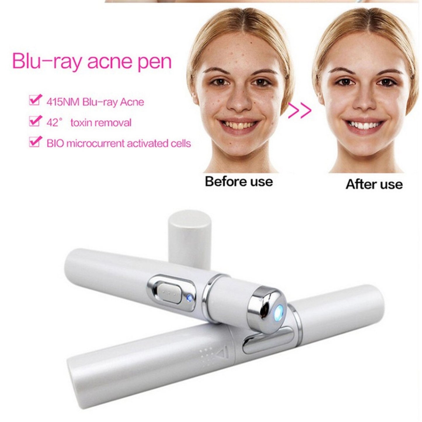 LumiGlow - Acne Laser Pen