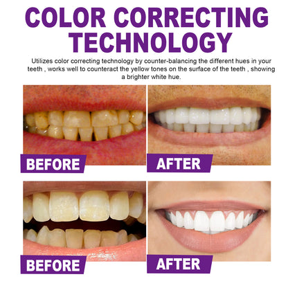 UltraSmile U Whitening Purple Toothpaste