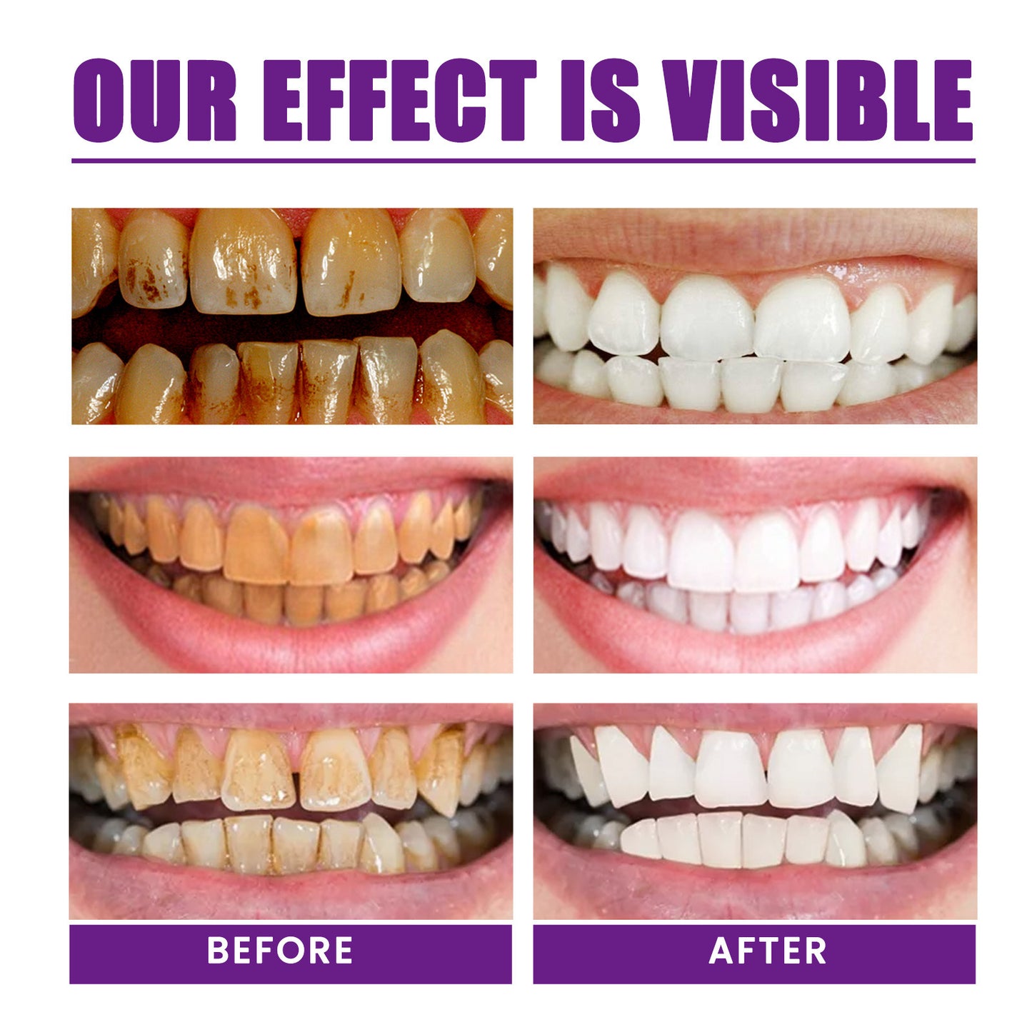 UltraSmile U Whitening Purple Toothpaste