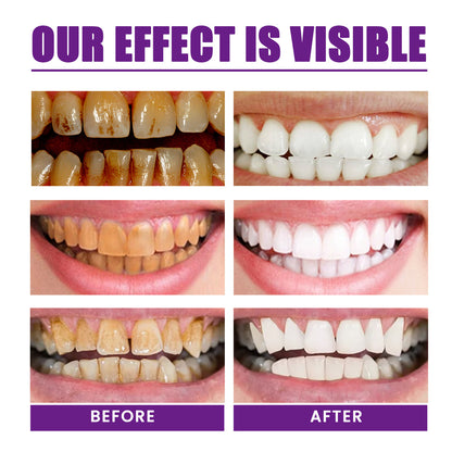 UltraSmile U Whitening Purple Toothpaste